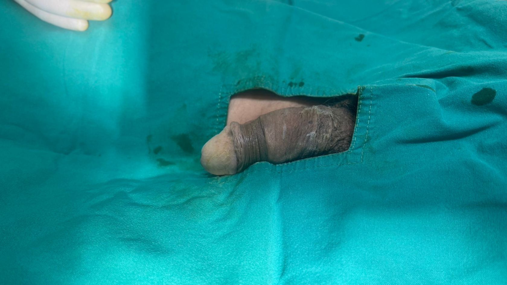 Before Circumcision