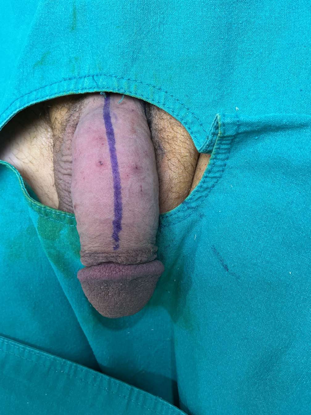 After Case