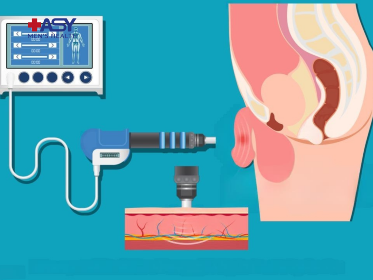 Shockwave Therapy