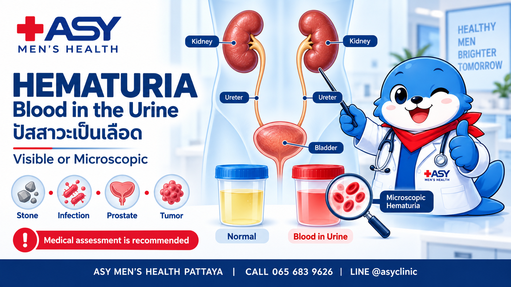 Hematuria infographic showing visible and microscopic blood in urine, urinary tract and ASY urologist mascot in Pattaya