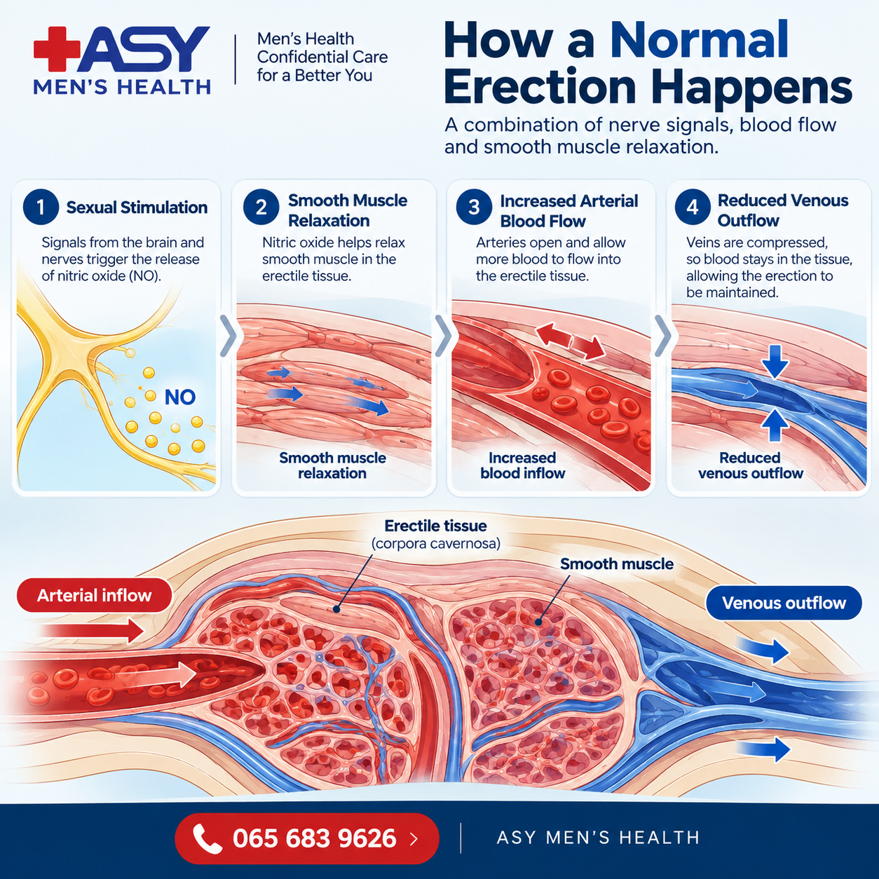 Infographic showing how a normal erection happens with increased arterial inflow and reduced venous outflow by ASY Men's Health